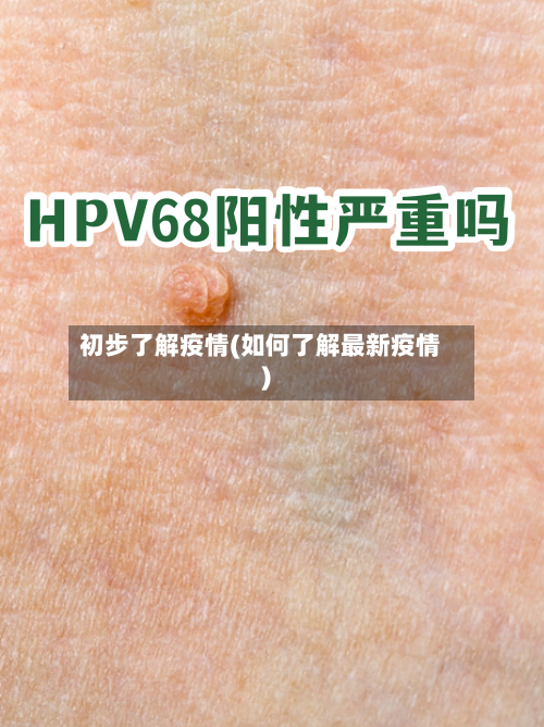 初步了解疫情(如何了解最新疫情)